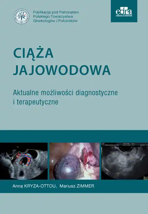 Darmowa dostawa Ciąża jajowodowa Aktualne możliwości diagnostyczne i terapeutyczne