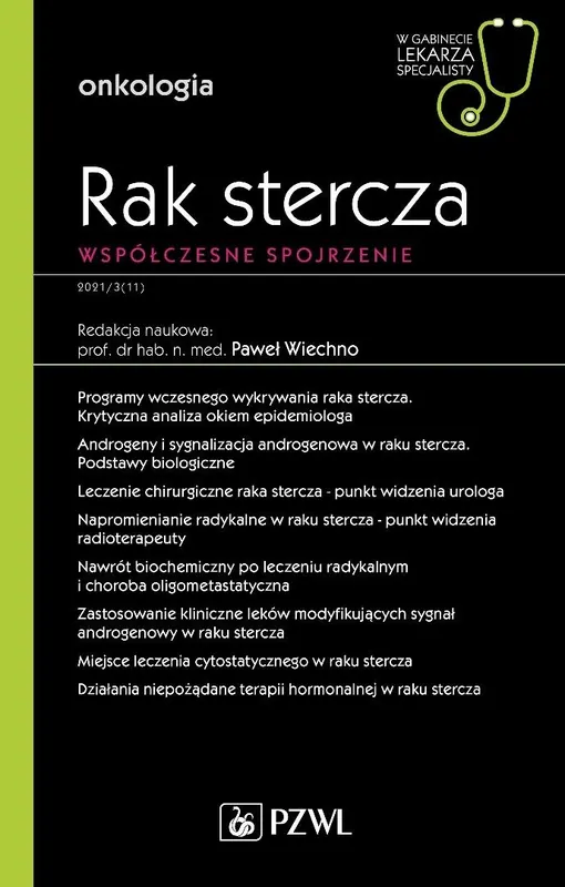 Rak stercza Współczesne spojrzenie Bezpieczne zakupy