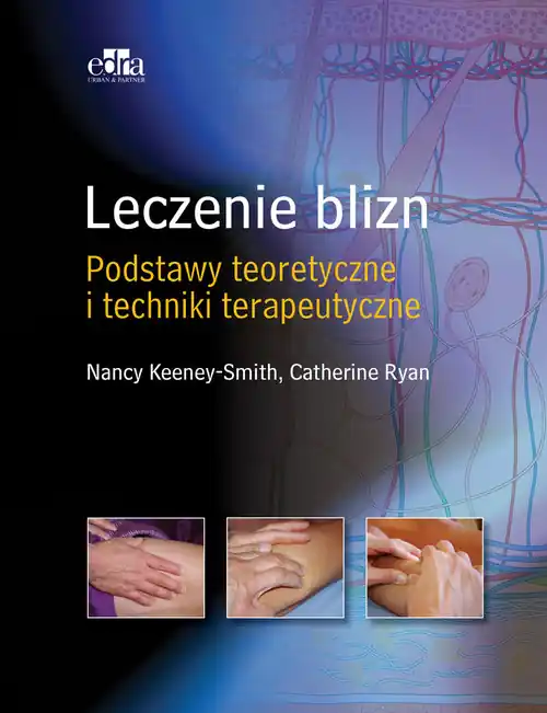 Leczenie blizn Podstawy teoretyczne i techniki terapeutyczne Obniżka ceny