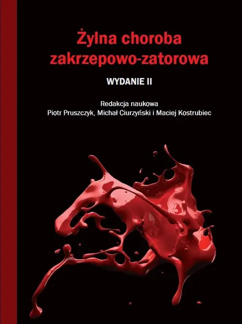 Żylna choroba zakrzepowo-zatorowa Tylko dziś