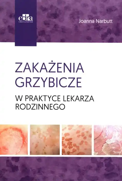 Zamów teraz Zakażenia grzybicze w praktyce lekarza rodzinnego