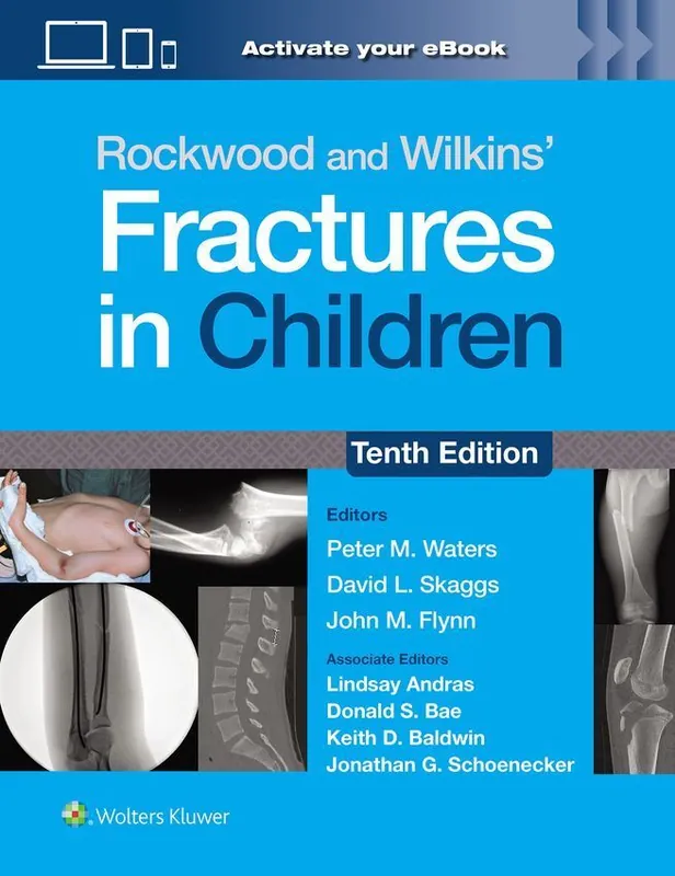 Dodaj do koszyka Rockwood and Wilkins' Fractures in Children: Print + eBook with Multimedia