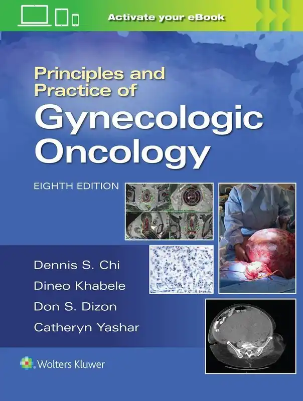 Rabat Principles and Practice of Gynecologic Oncology